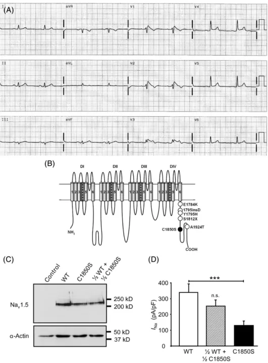 Figure 1 Electrocardiogram of the index case, mutations in Na v 1.5 C-terminus, and expression of wild-type (WT) and C1850S Na v 1.5 channels
