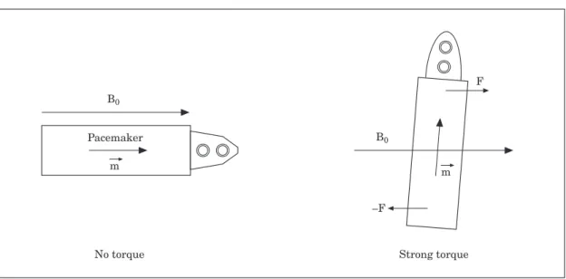 Figure 1 When the orientation of the pacemaker is optimal, the magnetic torque is relatively small (left).