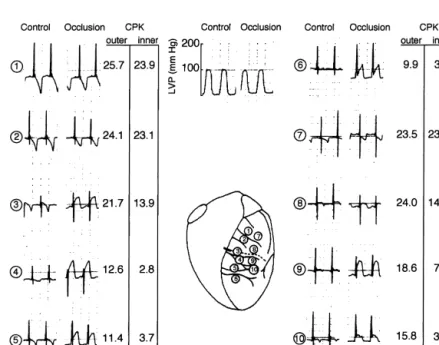 Fig. 2. Transmembrane action potentials recorded from the subepicardium of the left ventricle of an in situ pig heart before and after occlusion of the left anterior descending coronary artery (modified from Ref