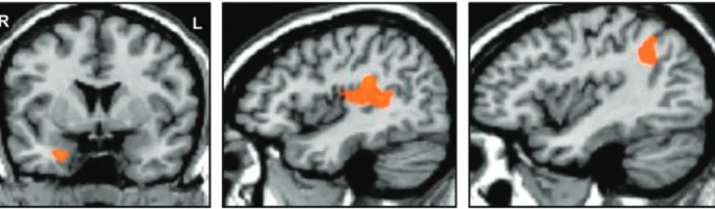 Figure 4. BOLD time course (mean ± SEM) of the right amygdala (left), the left temporal plane, and left superior temporal sulcus (middle), and the right intra-parietal sulcus (right) in response to rising (open circles), falling (black circles), and consta