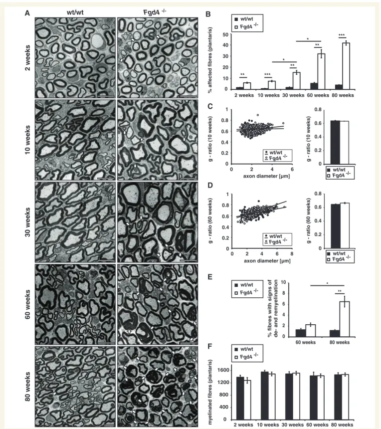 Figure 4 Fgd4  / mice develop a progressive demyelinating neuropathy with aberrant myelin formation