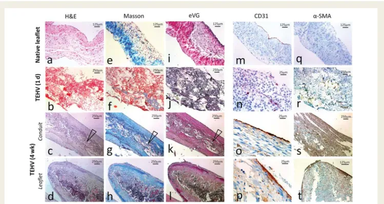 Figure 7 Qualitative tissue analysis. Mechanical properties of explanted tissue engineered leaflets after 4 weeks in vivo are displayed as stress – strain curves [MPa/%] characteristic for biological tissue (A)