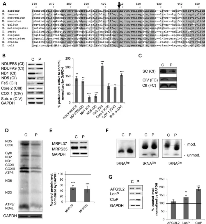 Figure 1. A novel pathological MTO1 mutation results in a Complex I + IV defect associated with a compromised mitochondrial translation, altered tRNA modiﬁcation and activation of mitochondrial proteases in patient ﬁ broblasts