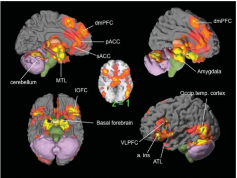 Figure 4. The Neural Reference Space for Discrete Emotion. The neural reference space (phrase coined by Edelman [1989]) is the set of brain regions consistently activated across all studies assessing the experience or perception of anger, disgust, fear, ha