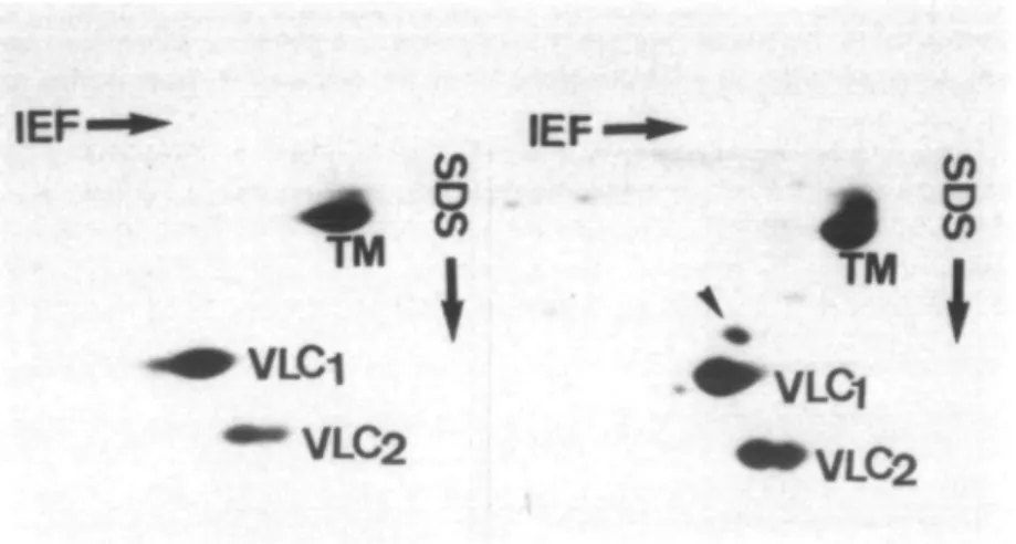 Figure I Two-dimensional electrophoresis of total tissue homogenate from left ventricles