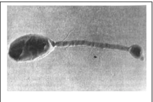 Figure 8 : Les bactéries bourgeonnantes à prosthèque Hiphomicrobium facilis avec hyphes et jeunes jeune  bourgeons 