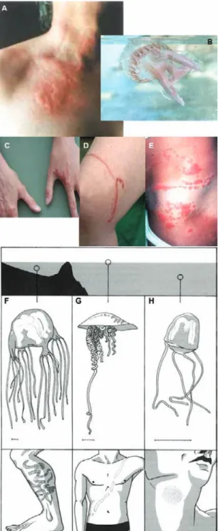 Figure 2. A, “Print” of Pelagia noctiluca; B, Pelagia noctiluca specimen;