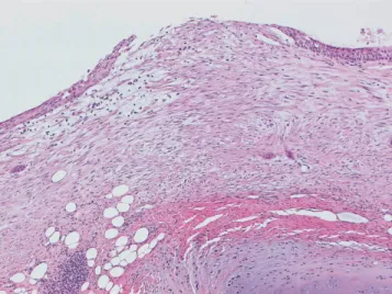 Fig. 2. Section of the trachea of a control animal (magnification £ 60).