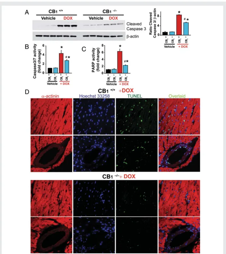 Figure 4 Acute DOX-induced myocardial apoptosis/necrosis is attenuated in CB 1 2/2