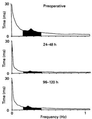 FIG. 1. Composite power spectral plots (0.01-1.0 Hz) of the preoperative period (top panel), the second day after operation (middle panel) and the fifth day after operation (bottom panel) in a typical patient undergoing elective hip arthroplasty under spin