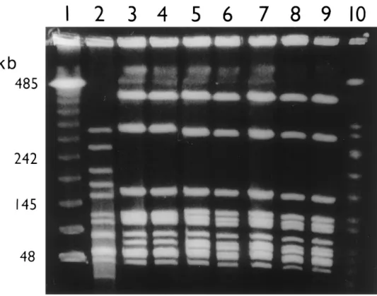 Figure 1. Pulsed field gel electro- electro-phoresis patterns of SmaI –digested chromosomal DNA from M6 strains of group A Streptococcus