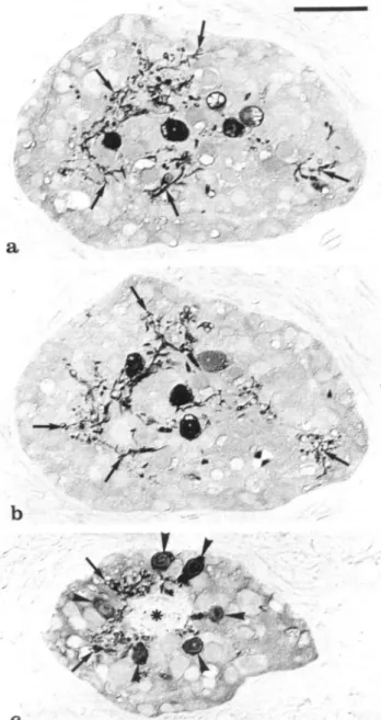 Fig. 5. Frontal organ. GABA-immunorcactive neurons. Horizontal sec- sec-tions (3 ^m). [a,b] Multipolar neurons with large dendritic trees  (ar-rows), [c] Neurons with cell bodies (arrowheads) and dendrites (arrows) in close apposition to the exit of the pi