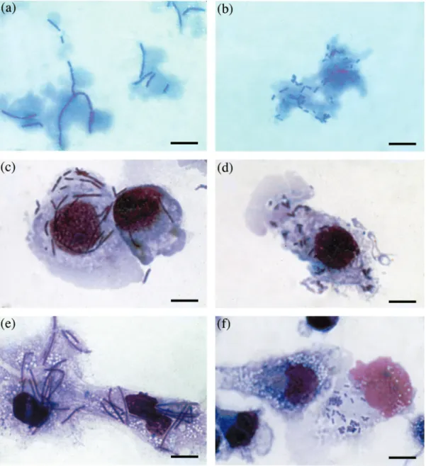 Figure 1. Photomicrographs of L. monocytogenes strain EGD in cell culture medium (a, b) and after phagocytosis by murine J774  (c, d) or human blood-derived (e, f) macrophages, showing the effects of co-trimoxazole and TMP on the morphology of bacteria