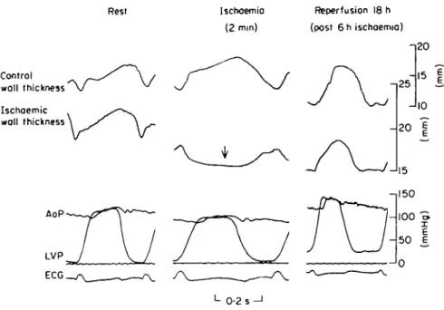 Figure 4 An original tracing showing the haemodynamic variables measured at rest (left), after 2 min of ischaemia (middle) and after 18 h of reperfusion (right)