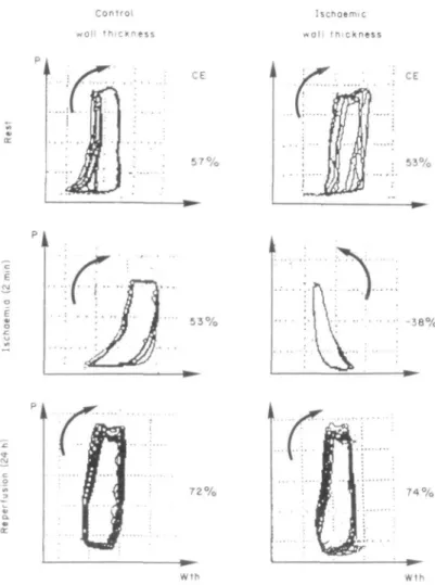Figure 5 Representative pressure (P)-wall thickness (Wth) loops of the con- con-trol (left hand panels) and ischaemic wall region (right hand panels)
