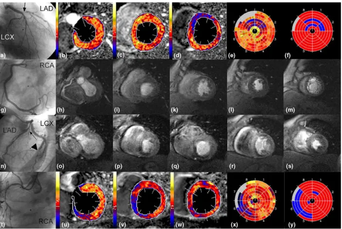 Fig. 5 Examples of MR perfusion studies for dose 1 (top rows a–m) and dose 3 (bottom rows n–y)