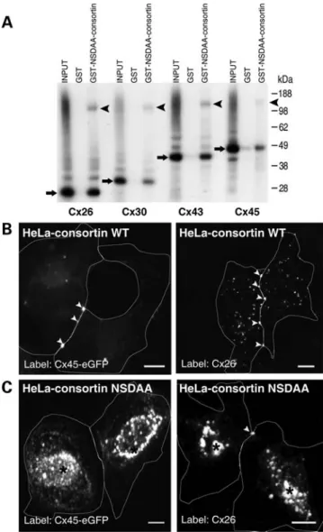 Figure 5. Consortin interacts with the TGN adaptors GGA1 and GGA2. (A) GST-pulldown assay of in vitro synthesized GGA1 with the GST-consortin chimera