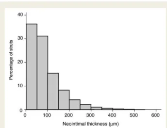 Figure 4 Distribution of neointimal thickness. Note that dimensions ,100 mm are below the resolution of intravascular ultrasound.