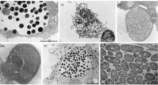 Figure 3. Electron micrographs of selected CLOs, demonstrating differences in cell morphology of EBs and RBs