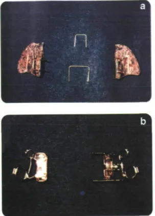 Figure 2 (A) The bonded MED before insertion. The 'U' form shaped heavy wires help to hold the acrylic parts together during bonding