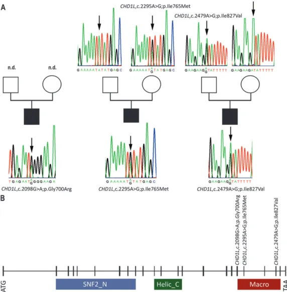 Fig. 1. Identification of CHD1L variants in CAKUT patients. Pedigrees and electropherograms of the three patients with the CHD1L missense variants: