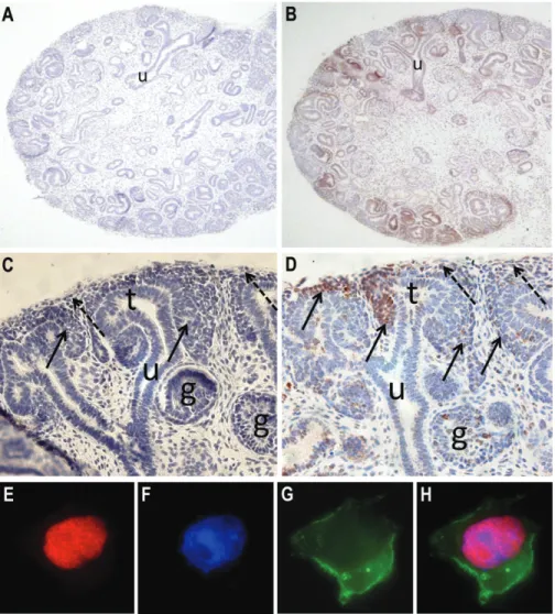 Fig. 3. Expression of CHD1L in developing human kidneys. Immunohistochemistry for CHD1L in 8–11 weeks human embryonal kidneys (A–D)
