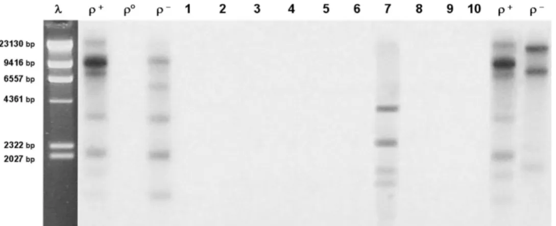 Table 2. Frequency of Ery R mutants
