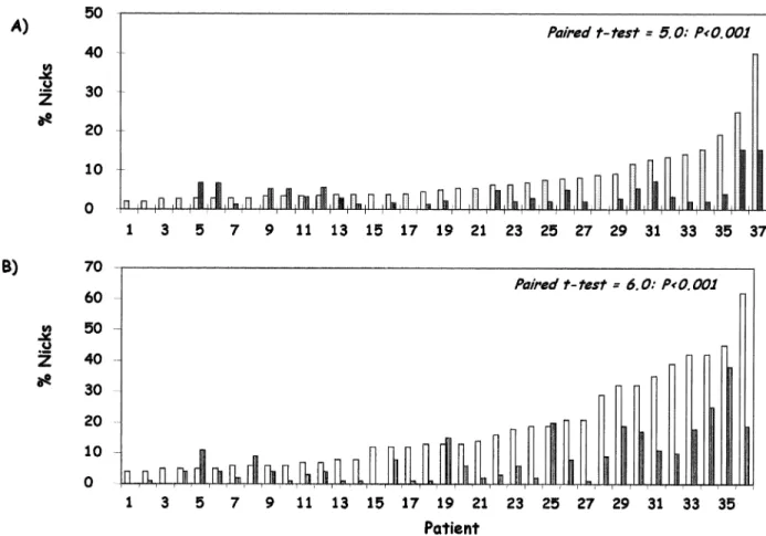 Figure 1. The percentage of human spermatozoa exhibiting endogenous DNA nicks in the 45% (white columns) and 90% (dark columns) fractions after preparation using (A) Percoll ® and (B) PureSperm ® 