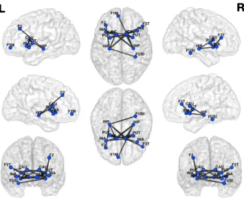 Figure 6.1. Network of hypoconnectivity in AN compared to HC at TP1. Network-based statistics were applied to compare whole-brain functional connectivity between the groups