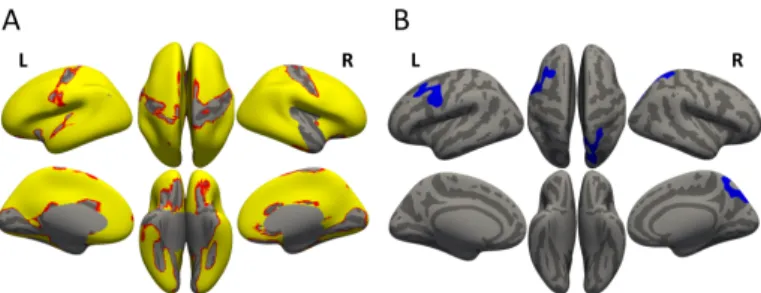 Figure 5.3. Cortical thickness. (A) Interaction of group × time, signi- signi-ficant increase with weight restoration in AN patients