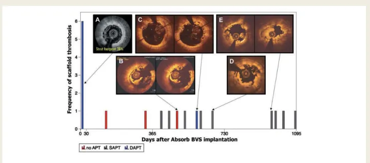 Figure 3 Time course and frequency of scaffold thrombosis in randomized clinical trials