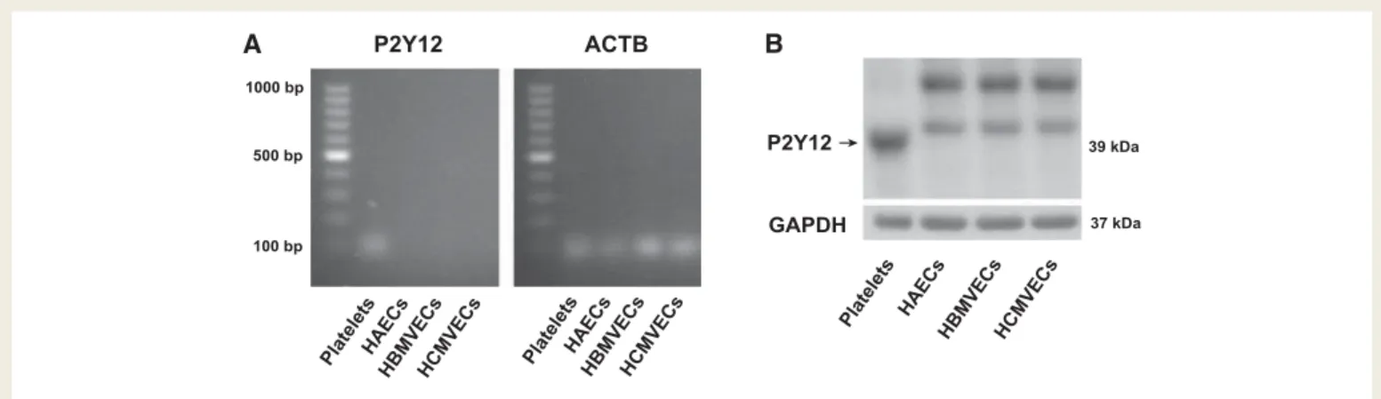 Figure 4 Presence of P2Y 12 receptor in human platelets but not in endothelial cells. (A) P2Y 12 RNA in human platelets compared with HAECs, HBMVECs and HCMVECs (n = 3)