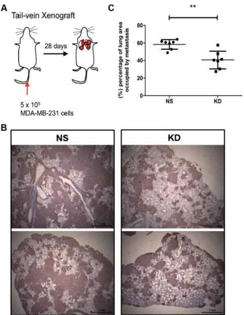 Figure 3: CYR61 down-regulated MDA-MB-231 cells decreases metastatic burden in an experimental model of  lung metastasis