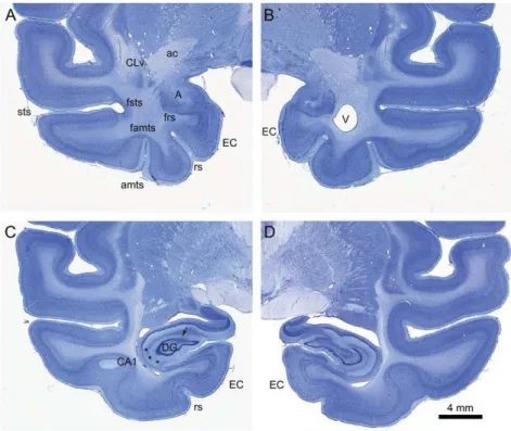 Table 1 Amygdala volumes in lesioned and control animals