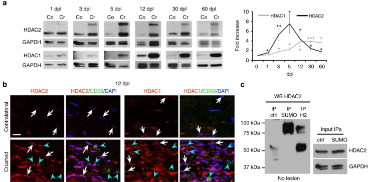Figure 1 | HDAC1/2 are robustly upregulated in SCs after lesion. (a) Western blots of HDAC2 and HDAC1 in lysates of crushed (Cr) and contralateral (Co) nerves of adult mice at 1 dpl (n ¼ 5), 3 dpl (n ¼ 5), 5 dpl (HDAC2, n ¼ 6; HDAC1, n ¼ 7), 12 dpl (HDAC2,