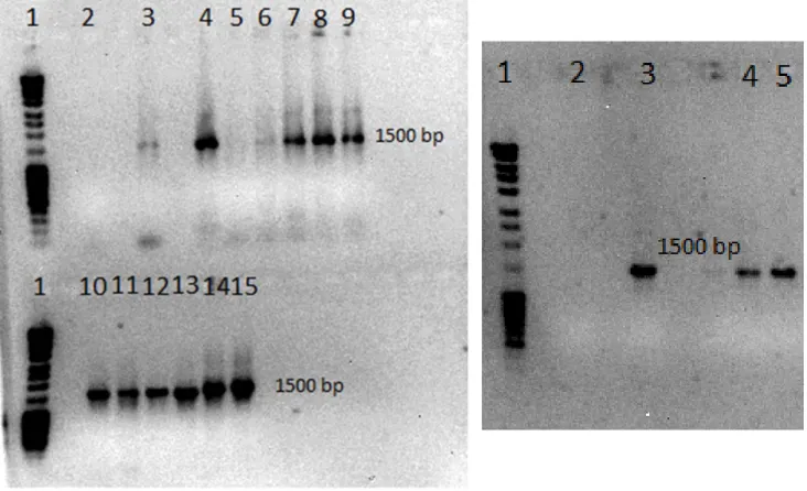 Figure  11:  Electrophoretic  analysis  of  colony  PCR products (1%, 100V for 1h). 
