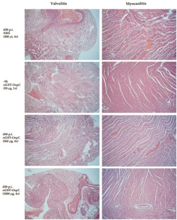 Figure 1. Histopathological examination of heart (day 155 p.i.) from B. burgdorferi-infected C.B-17 mice following either prophy- prophy-lactic or therapeutic treatment with rabbit IS specific for GST-OspC