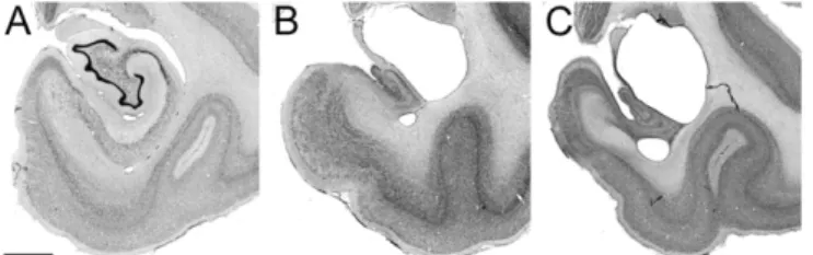 Fig. 1. Lesion evaluation. Nissl-stained sections of the monkey medial tem- tem-poral lobe at midrostrocaudal level of the hippocampus [Bregma −15.3 (43)].
