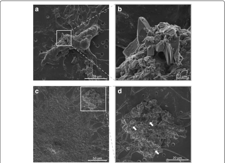 Fig. 4 Interaction of volcanic ash with the triple cell co-culture. Scanning electron micrographs of the triple cell co-culture membrane exposed to 0.26 ± 0.09 μ g/cm 2 of single exposure to volcanic ash (SEVA), showing direct interaction of VA particles w