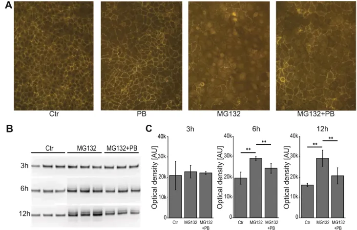 Fig. 1. Phenobarbital (PB) blocks b -catenin accumulation and nuclear translocation in 70.4 mouse hepatoma cells