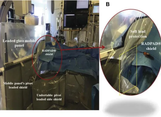 Figure 1. (A) Radioprotection equipment and materials. Image acquisition during a right radial case