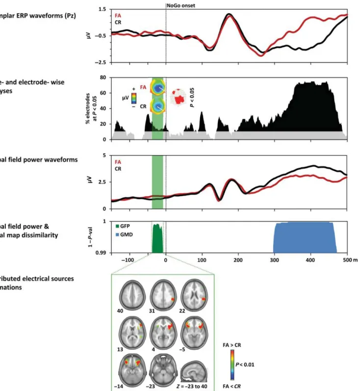 Fig. 3. Electrical Neuroimaging results. (A) Group-averaged event-related potential (ERP) at one exemplar electrode (Pz) for FA and CR