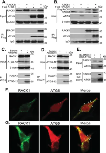 FIGURE 1. RACK1 is a novel ATG5 interactor. A, HEK293T cells were cotrans- cotrans-fected with plasmids encoding FLAG-tagged ATG5 and/or non-tagged  full-length RACK1 proteins