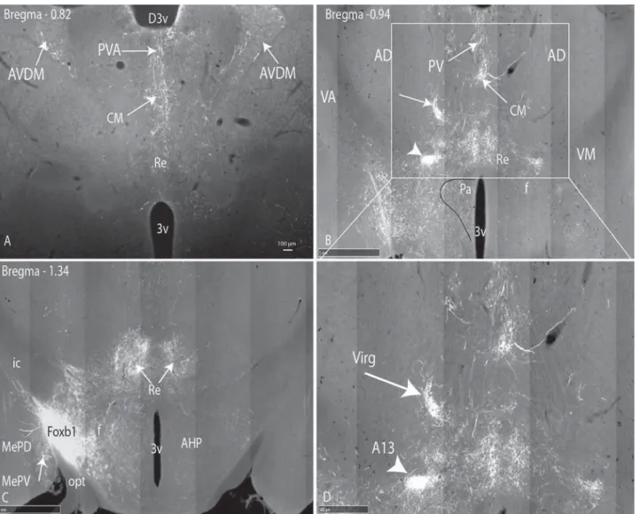 Figure 8. Epifluorescent images of coronal sections through the thalamus illustrating the projections thereto from the parvafox nucleus