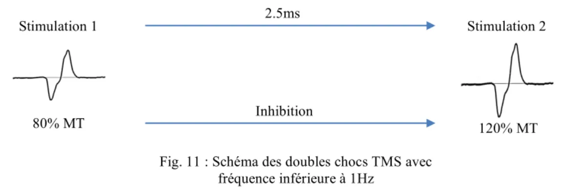 Fig. 11 : Schéma des doubles chocs TMS avec  fréquence inférieure à 1Hz 
