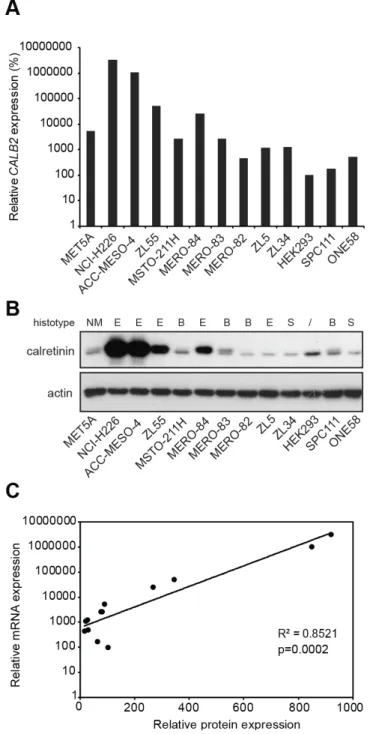Figure 1: Differential expression of calretinin in a panel of 13 cell lines.  (A) Quantitative RT-PCR analysis of CALB2 expression  in 11 mesothelioma cell lines, one immortalized mesothelial cell line (MET5A) and HEK293 cells using histones as an internal