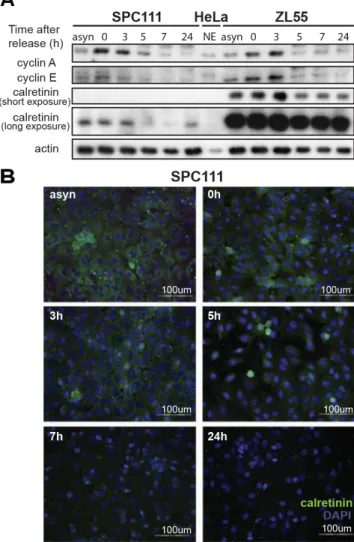 Figure 6: Cell cycle-dependent regulation of calretinin expression.  (A)  Calretinin levels in protein lysates from ZL55 and  SPC111 synchronized cells collected at different time points (0 h, 3 h, 5 h, 7 h, 24 h) after removal of thymidine block