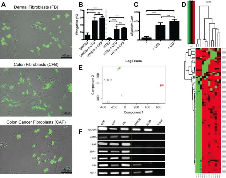 Figure 2: Cultured dermal, colon and colon cancer associated fibroblasts induce similarly cancer cell elongation and  motility and have equivalent gene expression and activation profiles