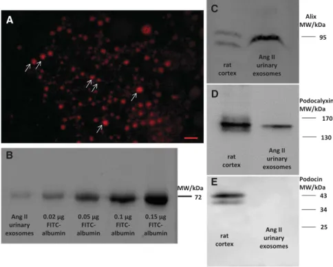 Figure 11. Urinary vesicles contain ﬂuorescent-labeled albumin and podocyte markers. Vesicles were isolated from the urine of rats, which were injected with either (A, arrows) Alexa BSA or (B) FITC – albumin before the Ang II infusion