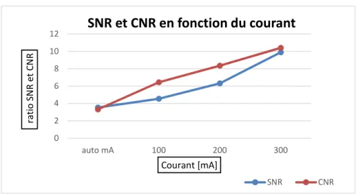 Figure 5 : Coupes du cœur aux différents pitch  a) 0.6  b) 0.875  c) 1.35  d) 1.675 auto mA100200 300024681012Courant [mA]ratio SNR et CNR SNR et CNR en fonction du courantSNR CNR